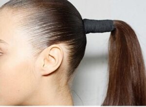 causes of traction alopecia