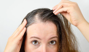 hair regrowth after traction alopecia