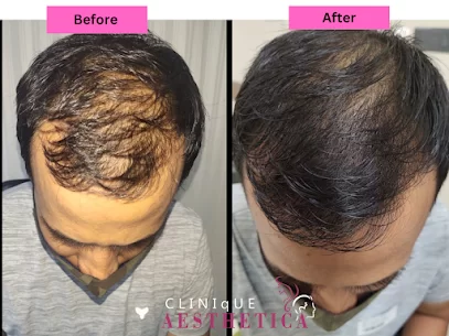 Before & After images - Hair Transplant in Mumbai by Dr. Vinod Vij