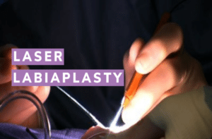Laser Labiaplasty