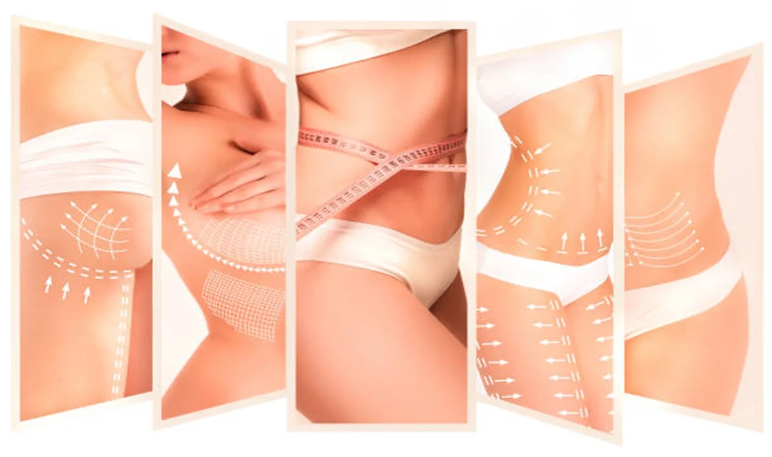 Body Contouring