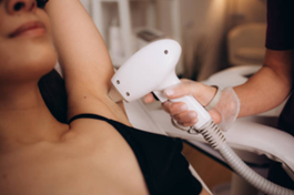 Underarm Laser Hair Removal