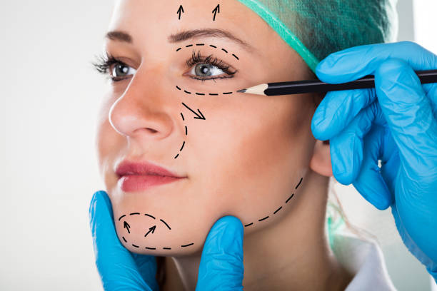 face surgery