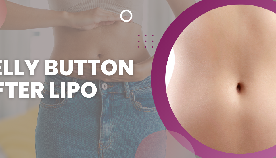 belly button after lipo