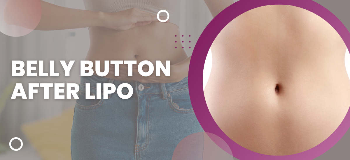 belly button after lipo