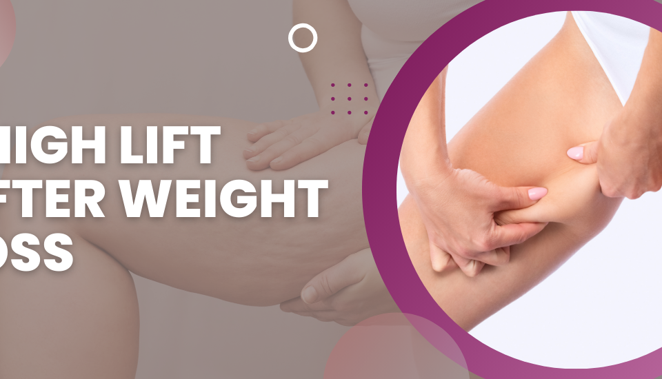 Thigh Lift After Weight Loss