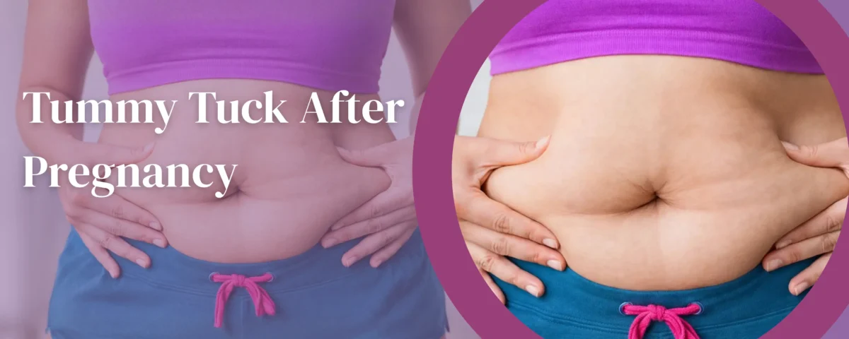 Tummy Tuck