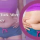 Tummy Tuck