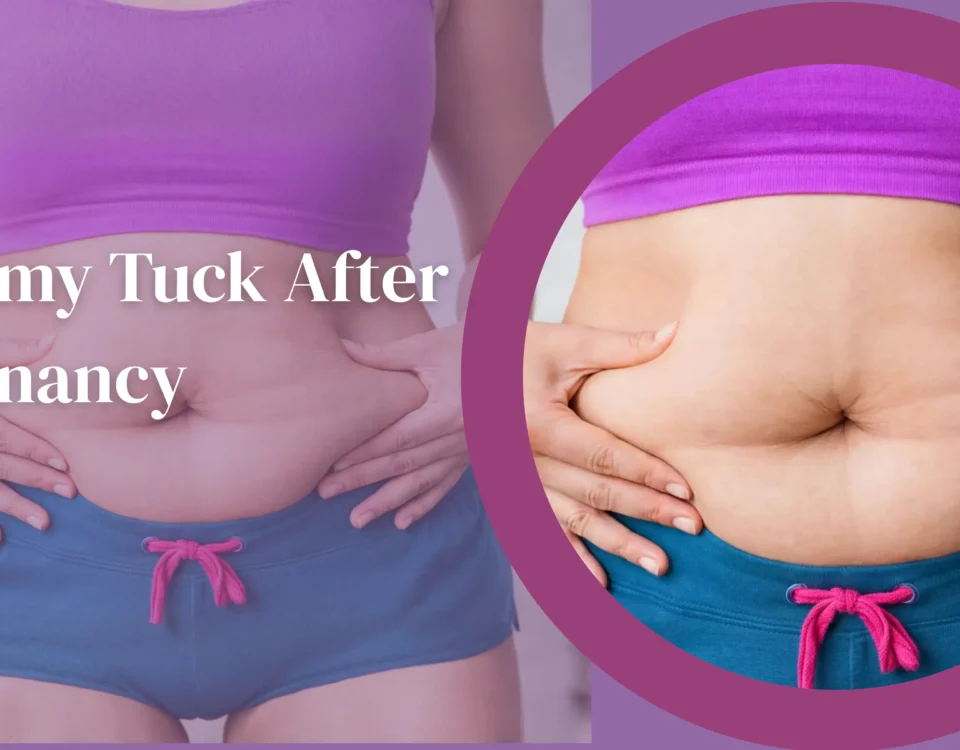 Tummy Tuck