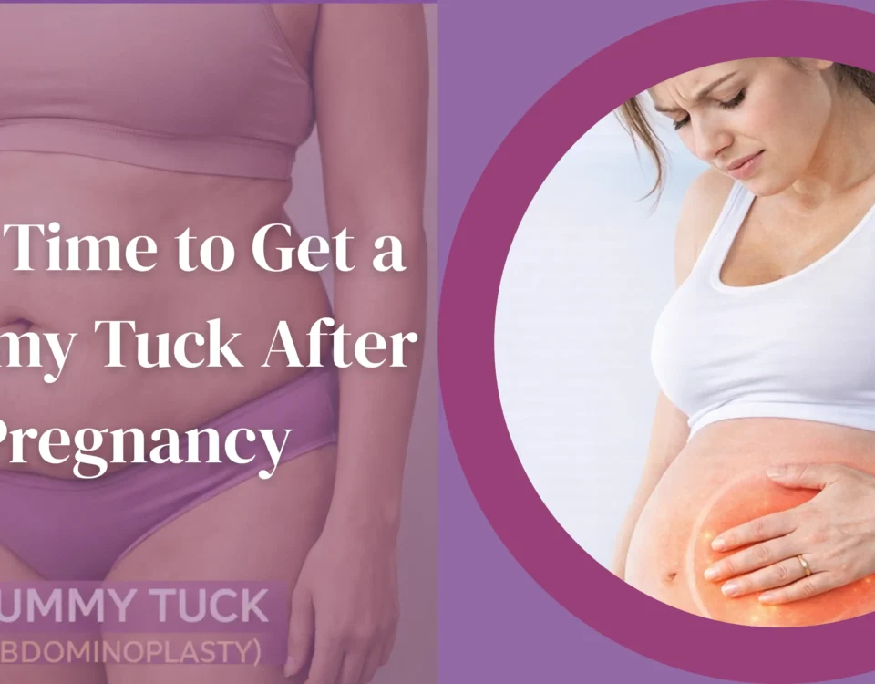 Best Time to Get a Tummy Tuck After Pregnancy