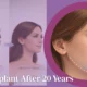 Chin implant results after 20 years showing long-term facial balance and natural jawline enhancement