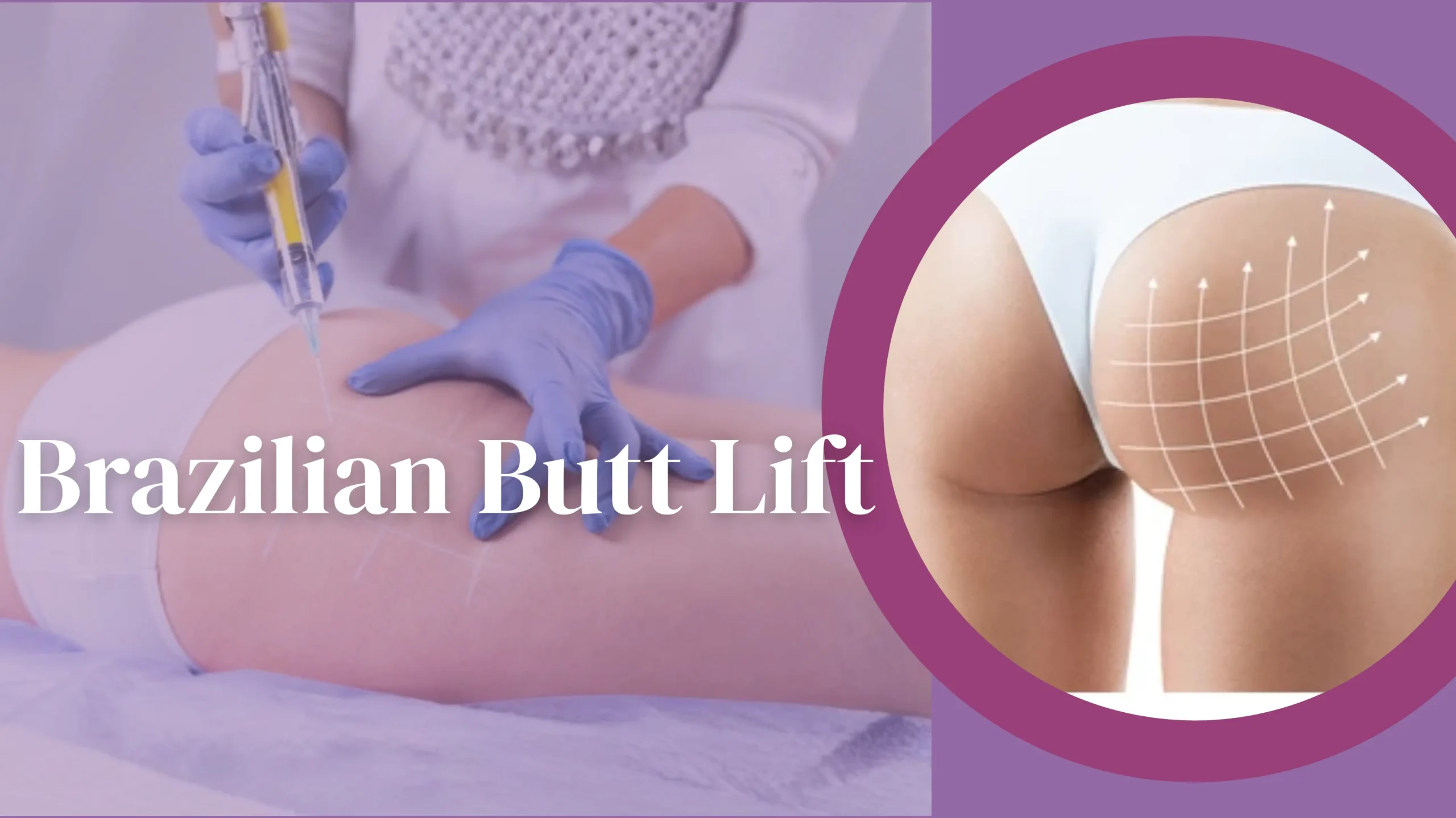 Medical illustration of Brazilian Butt Lift surgery procedure in Mumbai