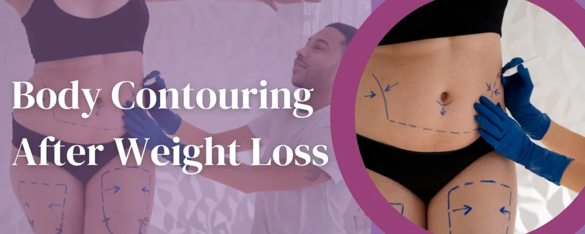 Before and after body contouring treatment showing fat removal and skin tightening