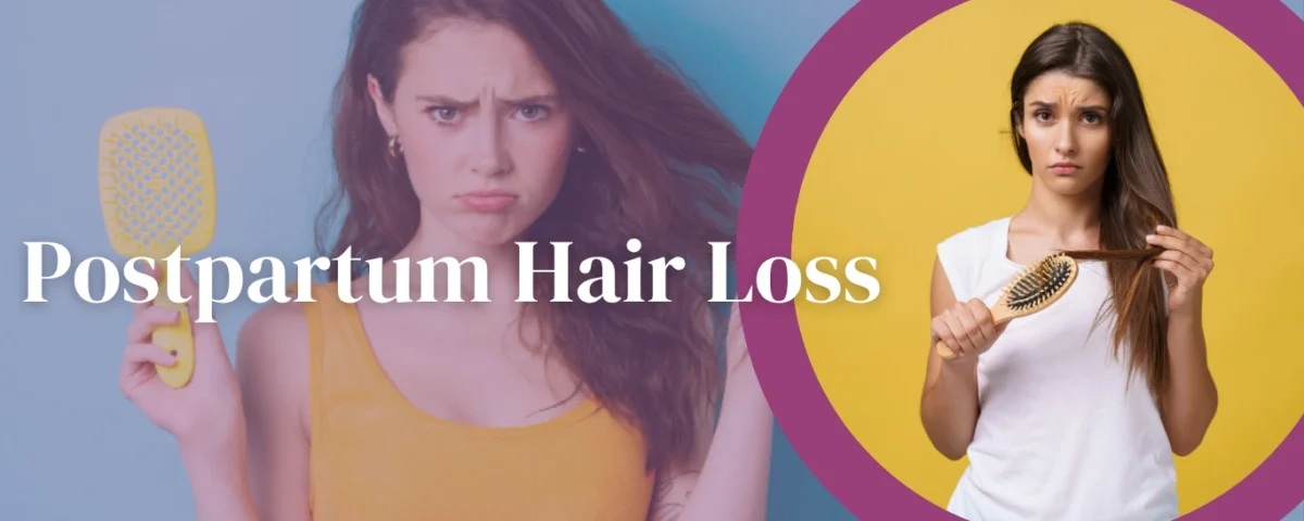 postpartum hair loss timeline and treatment options
