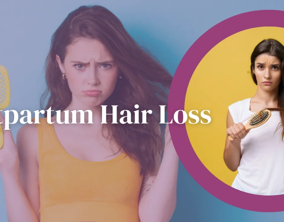 postpartum hair loss timeline and treatment options