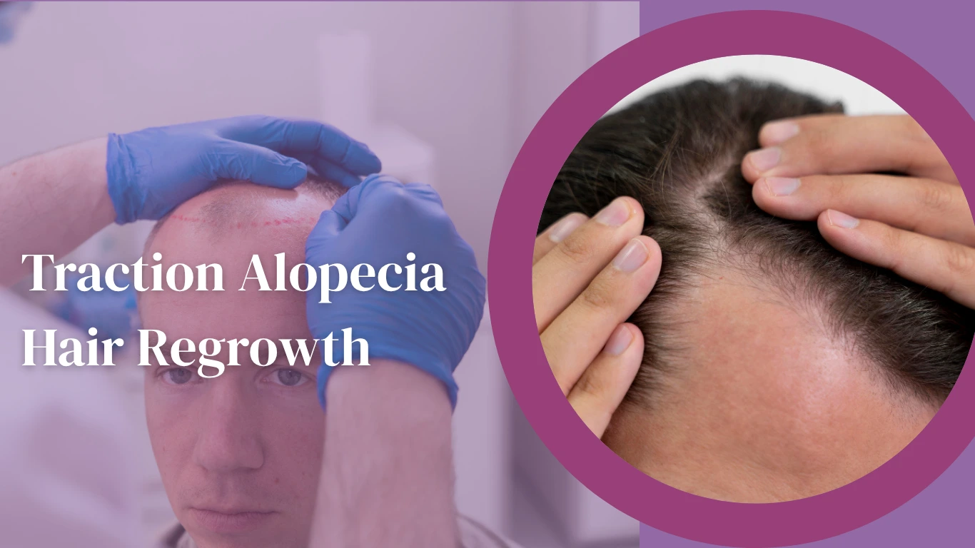 Traction Alopecia Hair Regrowth