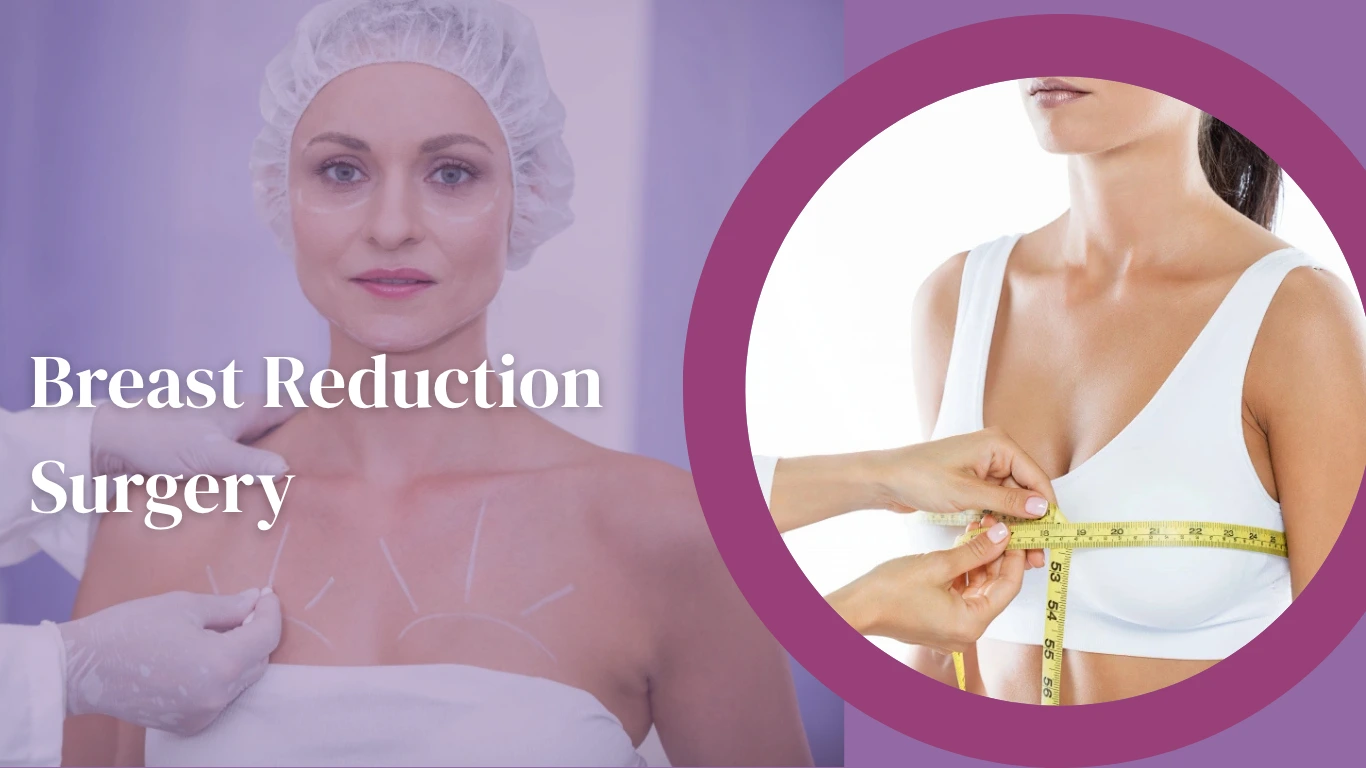 Breast Reduction Surgery