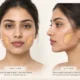 buccal-fat-removal