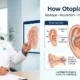 Doctor pointing to medical diagrams showing ear cartilage reshaping and repositioning techniques for correcting prominent ears