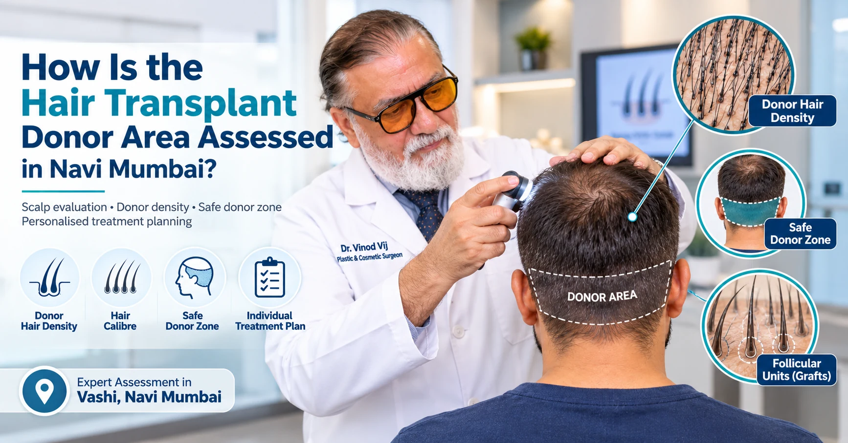 Dr. Vinod Vij assessing the hair transplant donor area, donor hair density and safe donor zone in Navi Mumbai.