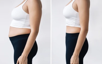 Liposuction Cost in Mumbai